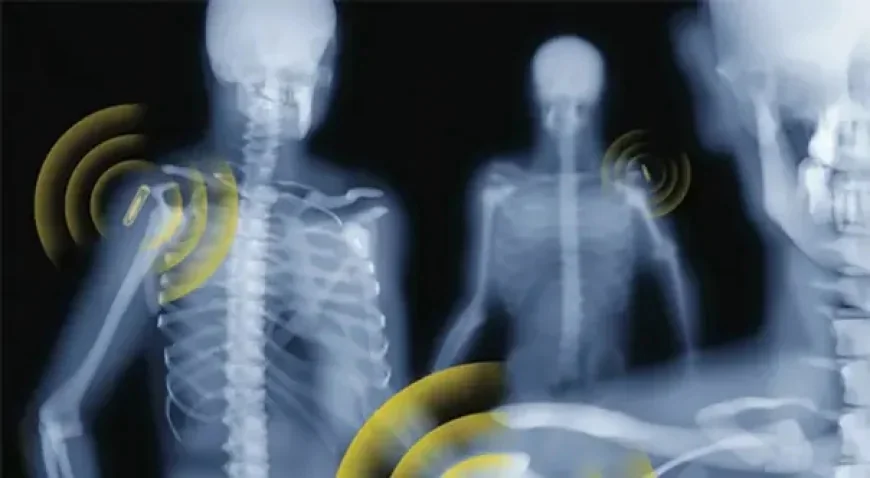 Identyfikacja radiowa pozwala kontrolować towary, usługi, zwierzęta, a nawet ludzi.